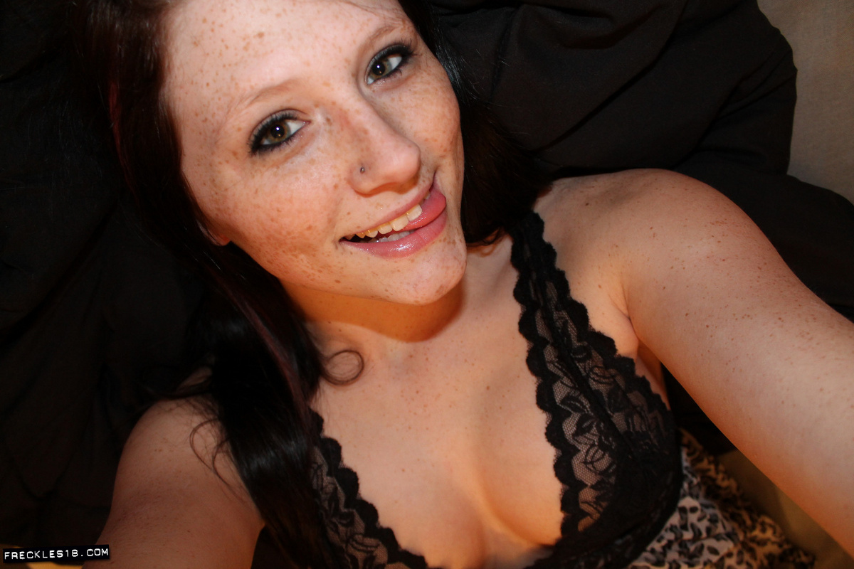 Freckles 18