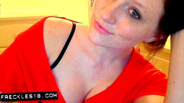 Freckles 18