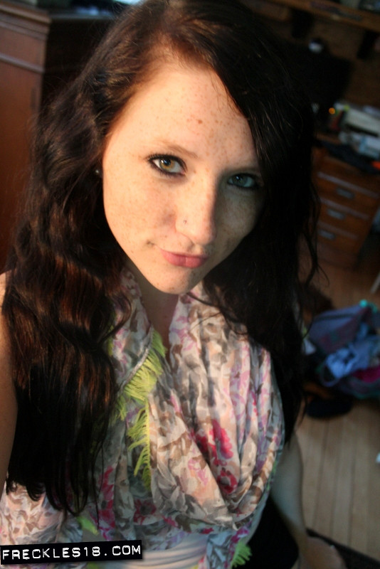 Freckles 18